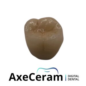 Couronne monolithique zircone multi-couche