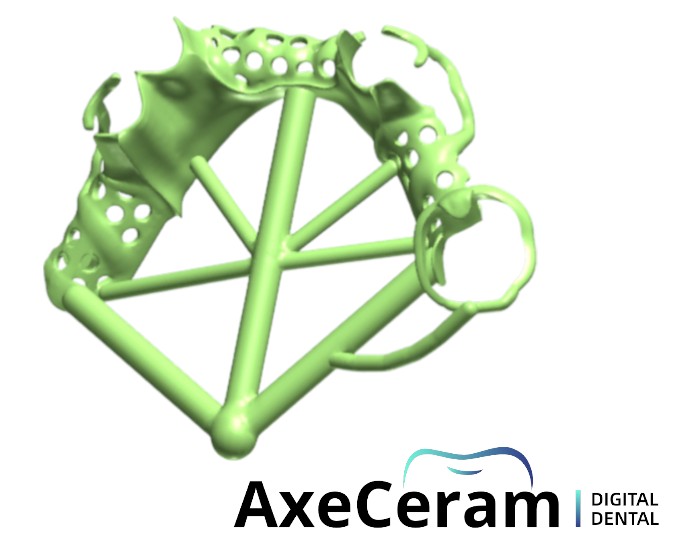 Châssis métallique SLM Châssis métallique SLM