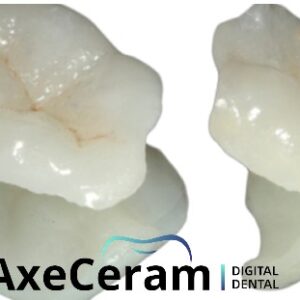 Couronne zircone stratifiée (CFAO)